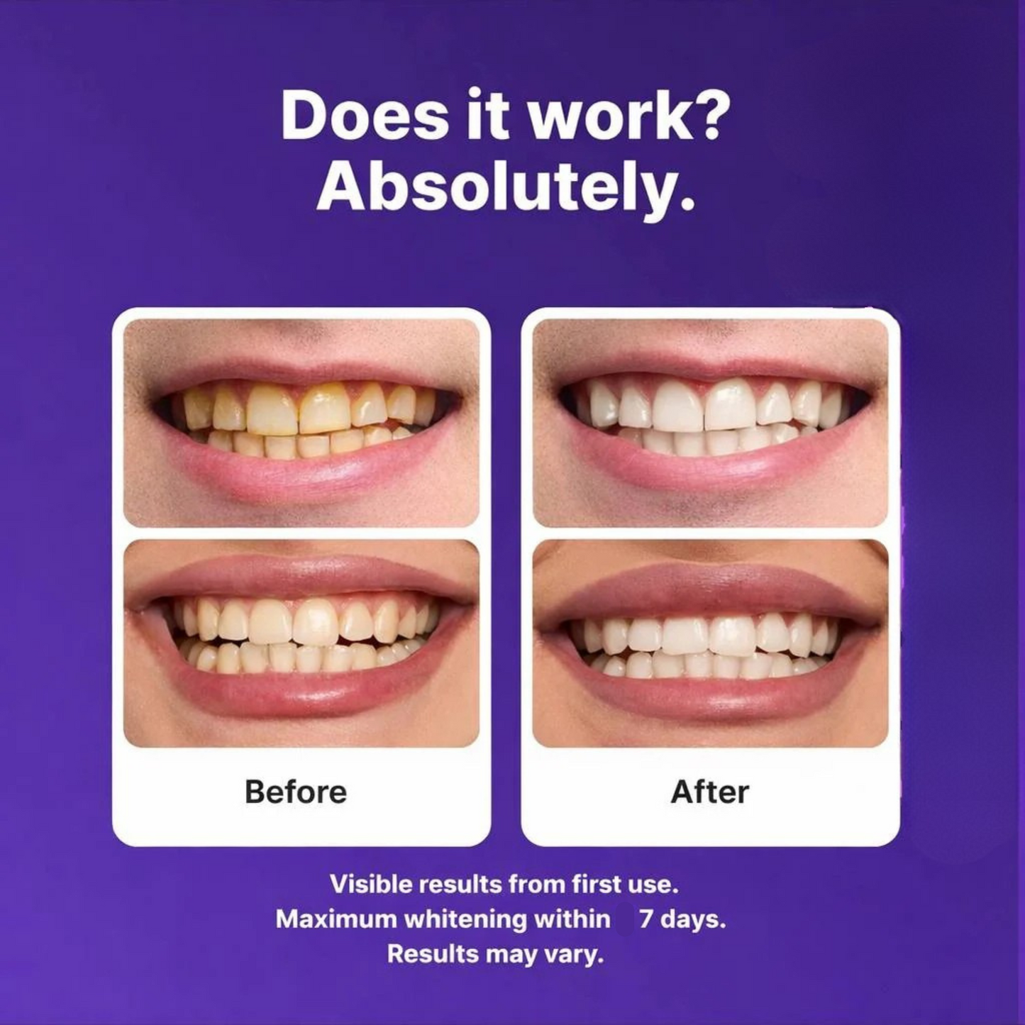 Cushymart Purple Teeth Whitening Strips™